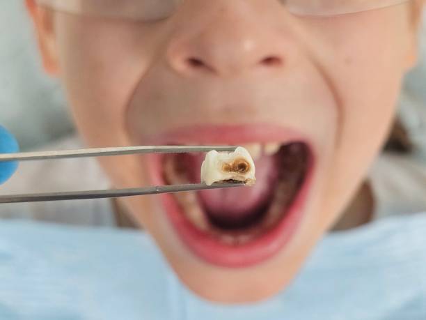 Best Knocked-Out Tooth Emergency  in Inkster, MI